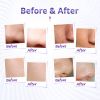 Diamond Tip Dermabrasion Microdermabrasion Machine Skin Rejuvenation Acne Remove Water Spray Facial Peeling Machine - white